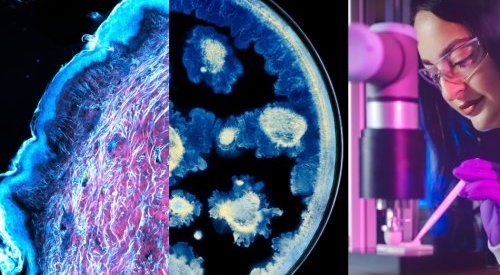 L'Oréal and the Pasteur Institute join forces on skin research