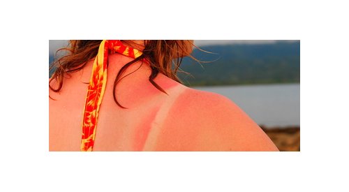Auto-bronzants : Une nouvelle substance pour aider la peau à produire de la mélanine sans UV
