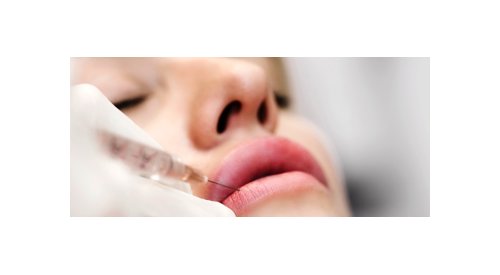 Pre-wedding cosmetic treatments are reportedly on the rise