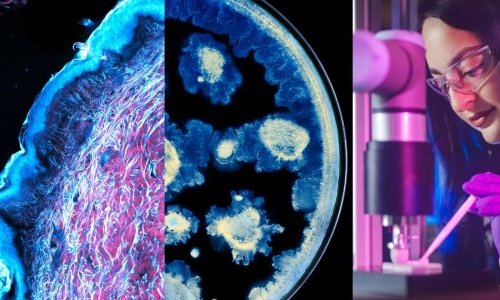 L'Oréal et l'Institut Pasteur nouent un partenariat de recherche sur la peau