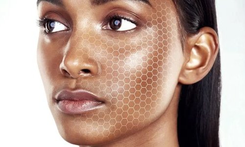 Thea Care : l'IA conçue par des dermatologues contre le déficit de conseil