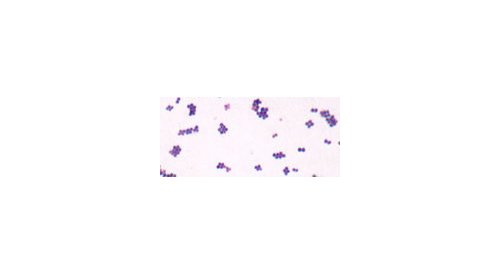 A new ISO standard to evaluate the antimicrobial protection of cosmetics