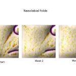 Protocole in vivo : Essai randomisé de 4 semaines (41 adultes) comparant placebo vs 10 % EcoCera PLEX. Évaluations : 30 min, 2 semaines et 4 semaines.