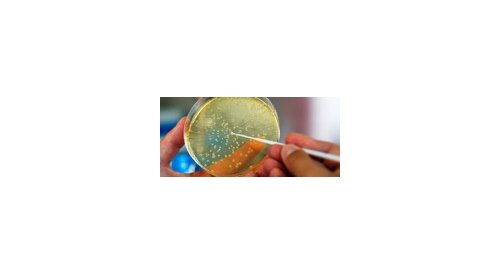 Une nouvelle méthode pour identifier les substances allergènes