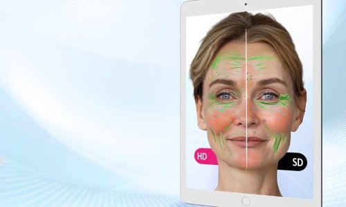 Perfect Corp: AI and 3D tech for increasingly accurate skin diagnosis
